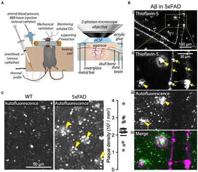 Preserved blood-brain barrier and neurovascular coupling in female 5xFAD model of Alzheimer’s disease